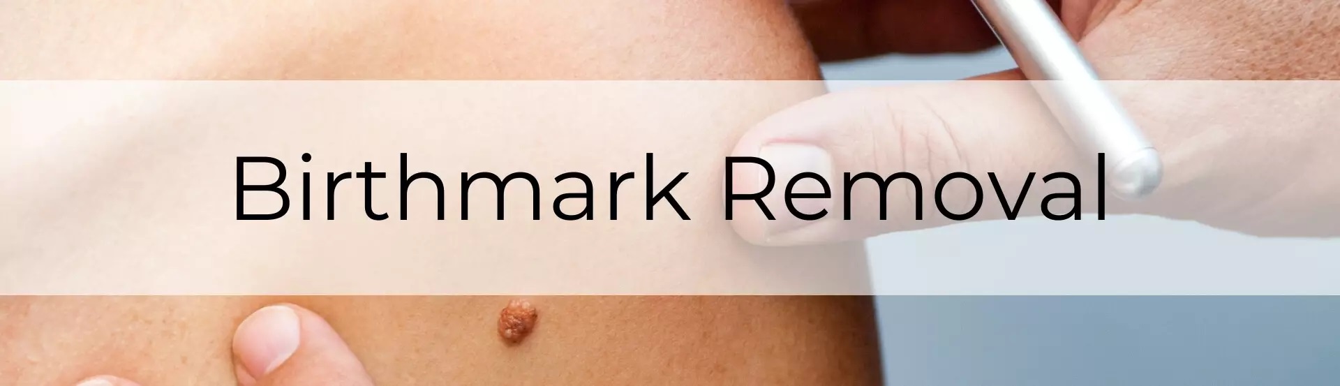 Birth Mark Treatment