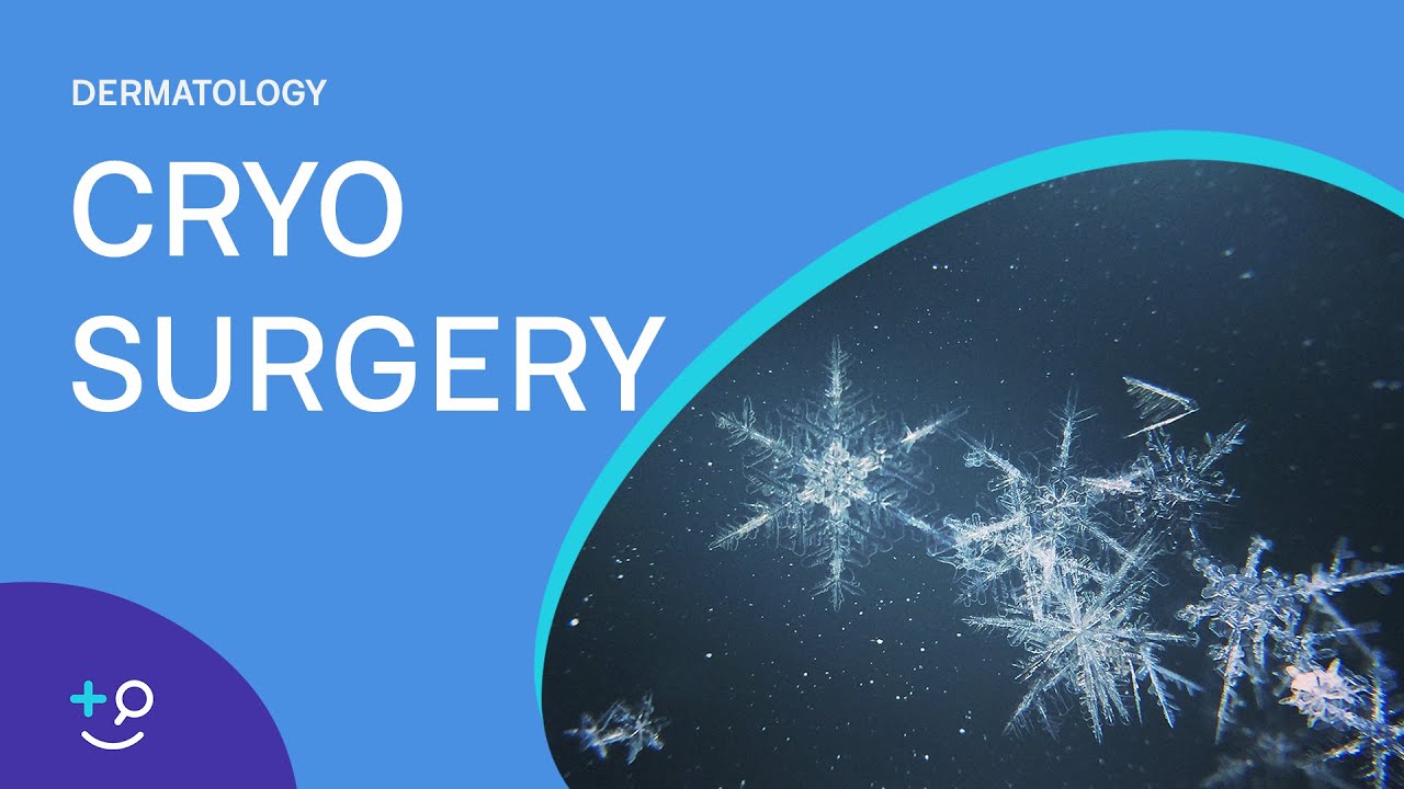 Cryo Surgery