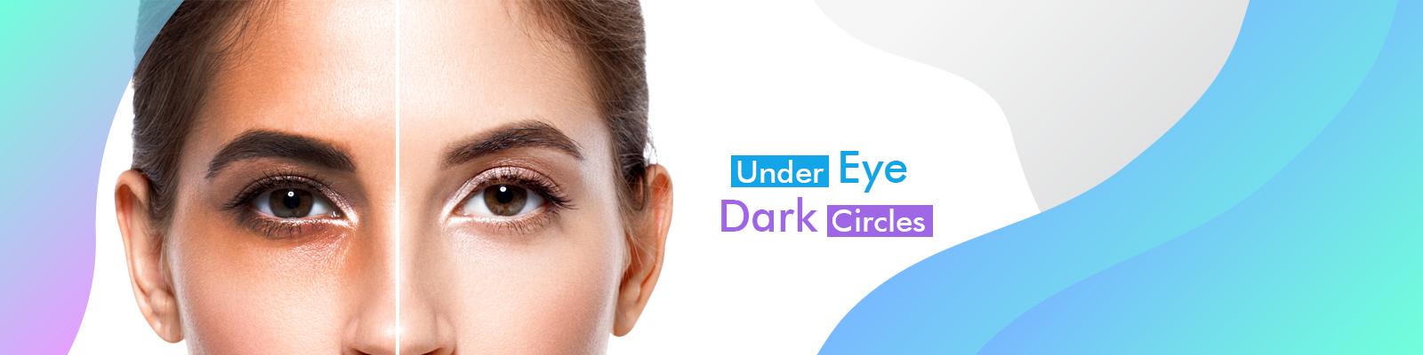 under_eye_ dark_circles