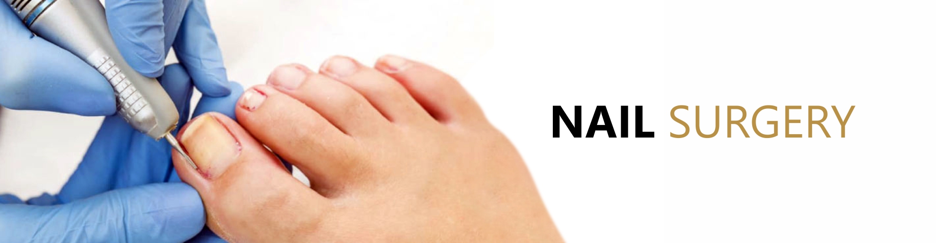 Nail Surgery - Feet First Thame